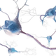 Illustration for article titled Goddammit, We Still Cant Cure Alzheimers Disease
